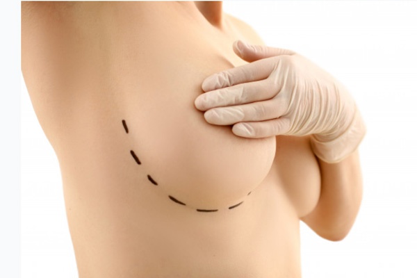 Lựa chọn phương pháp nâng ngực tiên tiến tại Yanhee 
